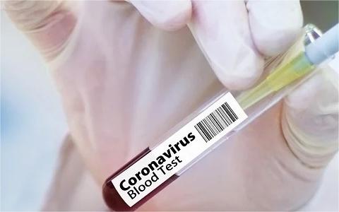 中國藥用玻璃行業(yè)調(diào)研